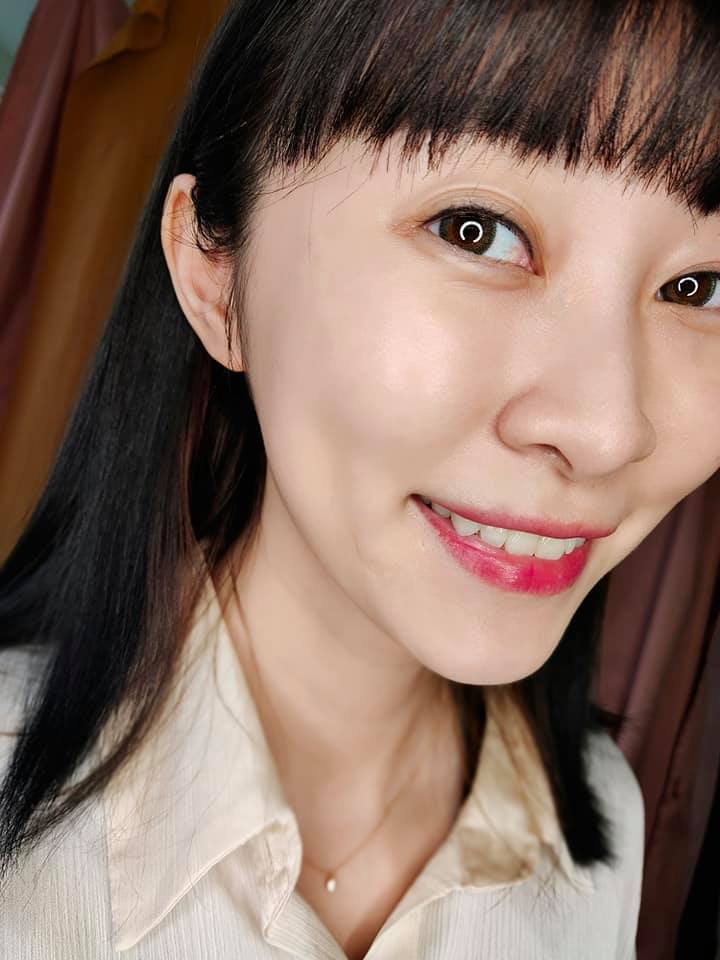 【皮秒雷射】逆時整形外科診所(大安)-皮秒真的厲害 ，現在一周後只能說滿意到不能再滿意 ！！～-Moon沐木